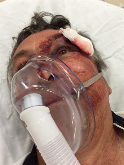 Cyclist recalls nothing of bad fall
